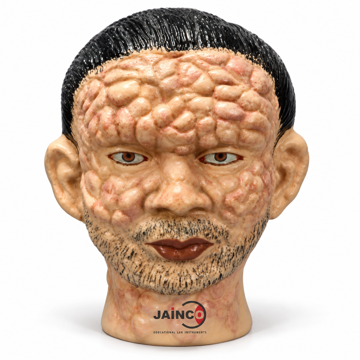 Leprosy Face Model